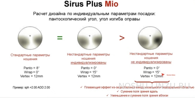    BBGR Sirus Plus Mio 1.5 Diams Clear UV